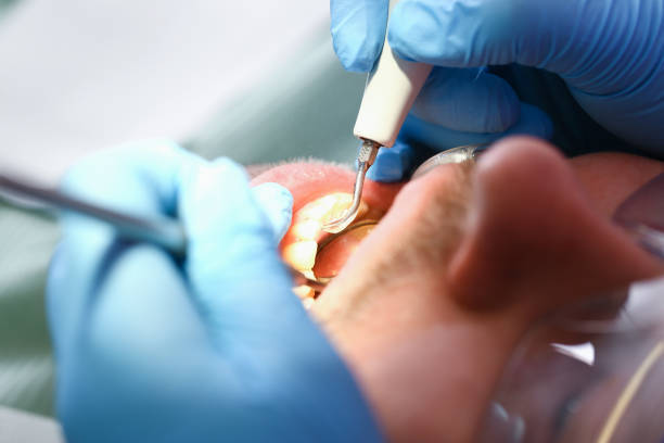 Best Pediatric Emergency Dentist in Twin Rivers, NJ